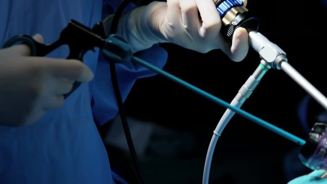 Reveal surgical hospital specialist team in scrubs in the operating theatre performing laparoscopic surgery using video monitor playback and Endoscope and Laparoscope instruments 