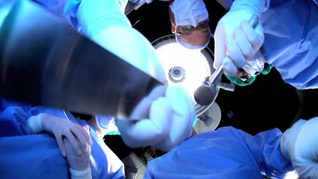 Patient POV Medical Caucasian male and multi ethnic female surgical team in scrubs performing Orthopedic surgery on the patient in operating theatre using surgical tools 