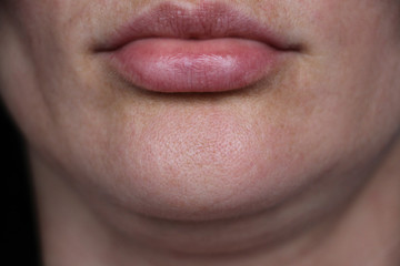 Obraz premium face line correction. a woman with a second chin