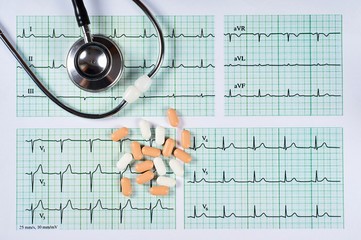 Electrocardiogram EKG graph paper, stethoscope and pen, Close-up.