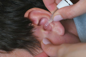 Woman buries drops in a man's ear. Treatment of ear diseases. hands and ear close-up.