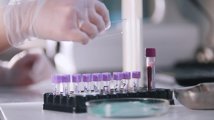 A woman working with flask in medical laboratory
