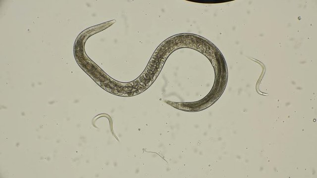 female roundworm Turbatrix aceti