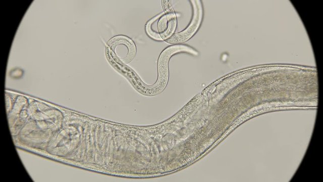 The female roundworm Turbatrix aceti gave birth to two nematodes formed at once