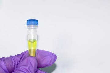 Tubes with ingredients necessary for real time PCR