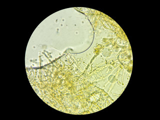 Image of microscopic fungs obtained through a light microscope
