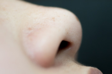nose