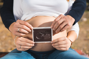 Close up of pregnant woman and her husband holding ultrasound scan on her tummy