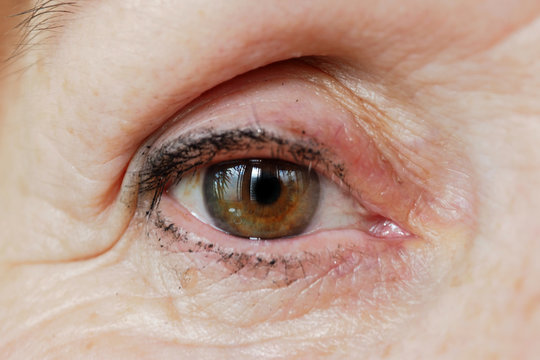 View eyes of an elderly woman macro. Old grandmother eye. 