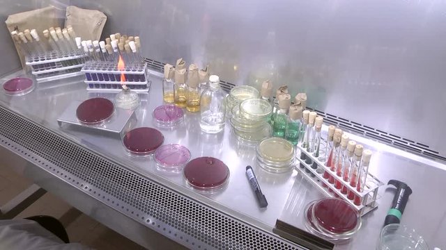Lab worker analyzing meat sample magnifying glass. Laboratory studies of meat and meat products. Checking meat for compliance with sanitary requirements.