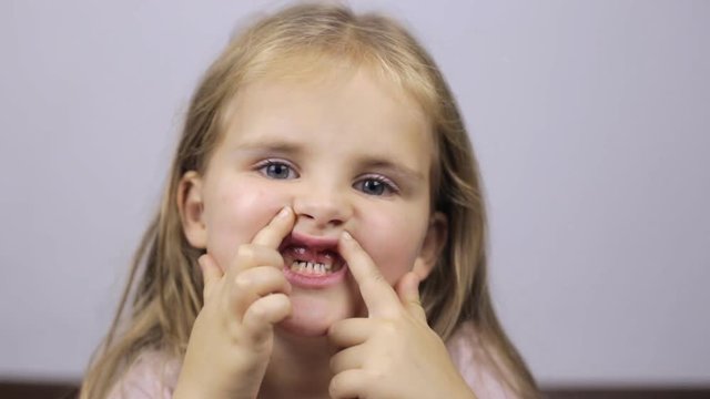 Child without front teet