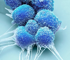 Close up of prostate cancer cells