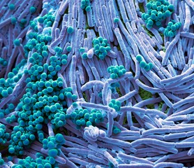 Close up of bacteria found on mobile phone