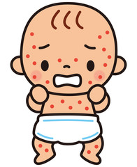 湿疹の出た赤ちゃん
