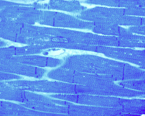 Intercalated disks. Cardiac myocytes