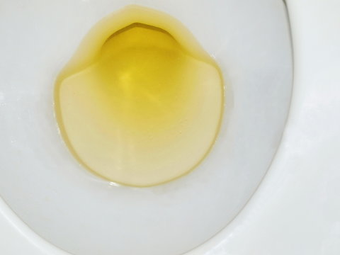 Closeup Urine or yellow pee in white flush bowl toilet in restroom.Toilet bowl full of urine.selective focus.