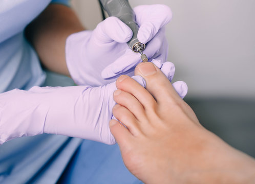 Chiropodist treating a patient's foot, pedicure treatment