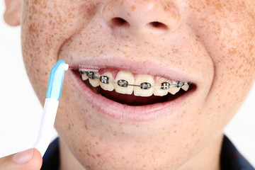 Young boy with dental braces and toothbrushes