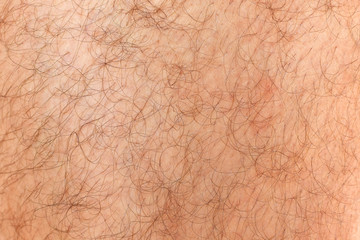 Hairy man's leg, background. Fragment of skin covered with hair, male body.