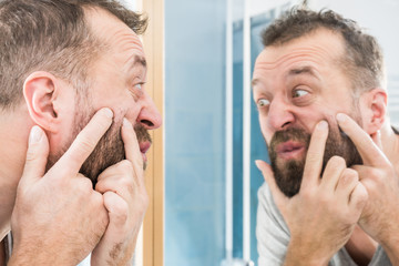 Man looking at pimples on his face