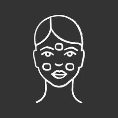 Anesthetic cream for neurotoxin injection chalk icon