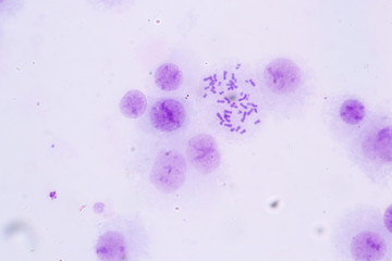 Chromosomes Human under the microscope for education.