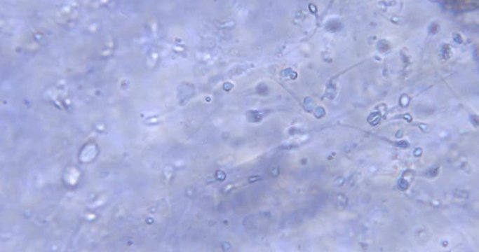 chaotic movement of cells under a microscope