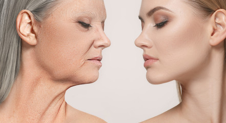 Comparison. Portrait of beautiful woman with problem and clean skin, aging and youth concept,...