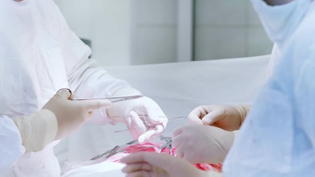 Close-up hands group of professional surgeons performing operation on abdominal cavity
