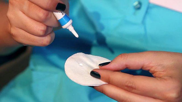 Ointment on a napkin, girl squeezes eye ointment on a napkin, Squeezing out an ointment from a tube, Treatment of the eyelid with ointment on the cotton swab to fight the mite demodex,  