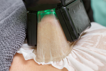 Woman getting cryolipolysis fat treatment in professional cosmetic cabinet