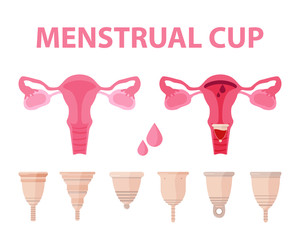 Collection of menstrual cups. Illustration of use of menstrual cup during periods. Menstruation theme. Different sanitary cups. Female reproductive organs. Colored flat icons, vector design