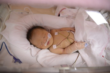 NICU BABY