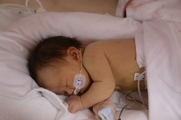 NICU BABY
