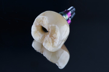 ceramic crown on a tooth chewing in complete