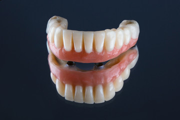 prosthesis of ceramic and artificial gums on a mirror