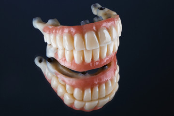 set of high-quality prosthetic implant into four lower and upper jaw