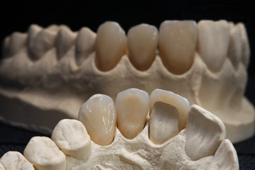 ceramic crowns, removed from the reflection in the mirror with black background