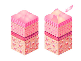 皮下組織のイメージ