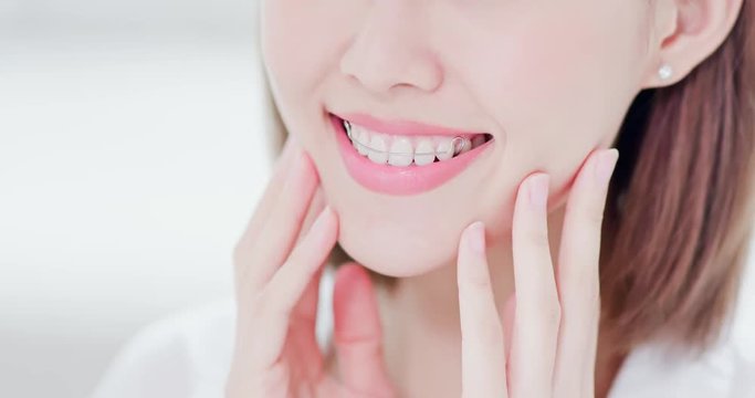woman with retainer for teeth