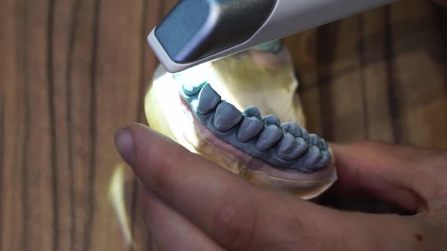 Dental technician scans a digital print from a wax model