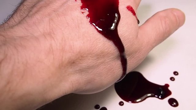 Hand with blood on white background.