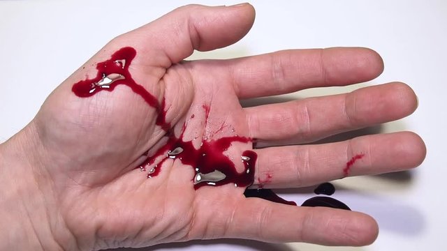 Hand with blood on white background.