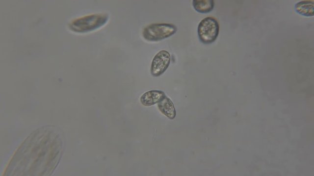 Motion of single-celled animals (infusoria) under microscope. Colony of ciliates Stylonychia under the microscope in lake water. Close up. UHD 4K