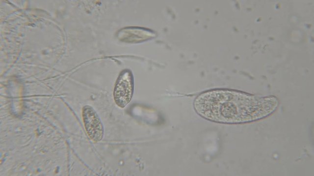 Motion of single-celled animals (infusoria) under microscope. Colony of ciliates Stylonychia under the microscope in lake water. Close up. UHD 4K