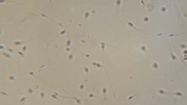Sperm (spermatozoa) viewed under the microscope. Moving human sperm under Phase contrast Microscope. Close up showing spermatozoons. Video semen under microscope. 4K UHD