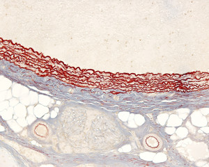 Pulmonary artery. Elastic laminae