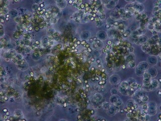 phytoplankton cells
