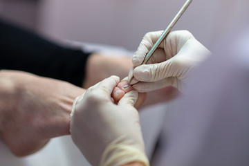 Making medical pedicure
