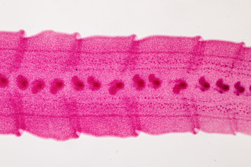 Patterns and backgrounds of Parasitic, Study for Anatomical pathology in laboratory.